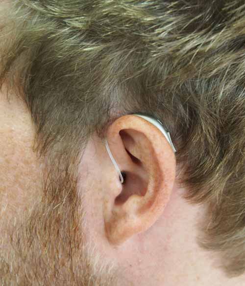 Unexpected Cause of Ear Ringing